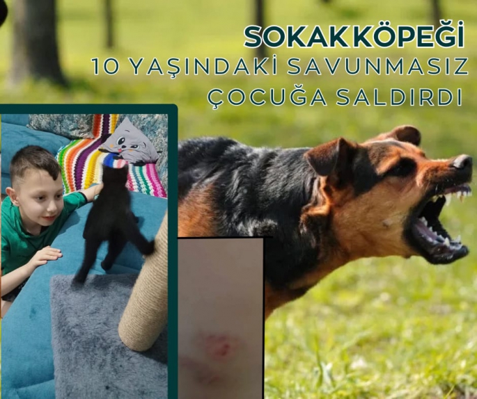 SOKAK KÖPEĞİ KÜÇÜK ÇOCUĞU ISIRDI